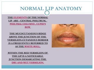NORMAL LIP ANATOMY
THE ELEMENTS OF THE NORMAL
LIP ARE - CENTRAL PHILTRUM,
PHILTRAL COLUMNS , CUPID'S
BOW
THE MUCOCUTANEOUS RIDGE
ABOVE THE JUNCTION OF THE
VERMILION-CUTANEOUS BORDER
IS A FREQUENTLY REFERRED TO
AS THE WHITE ROLL.
WITHIN THE RED VERMILION OF
THE LIP IS A NOTICEABLE
JUNCTION DEMARCATING THE
DRY AND WET VERMILION.
 