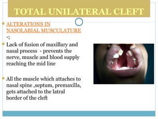TOTAL UNILATERAL CLEFT
ALTERATIONS IN
NASOLABIAL MUSCULATURE
-;
Lack of fusion of maxillary and
nasal process - prevents the
nerve, muscle and blood supply
reaching the mid line
All the muscle which attaches to
nasal spine ,septum, premaxilla,
gets attached to the latral
border of the cleft
 