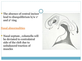 The absence of central incisor
lead to disequilibrium b/w 1st
and 2nd
ring
Nasal abnormalities
Nasal septum , columella will
be deviated to contralatral
side of the cleft due to
unbalanced traction of
muscles
 