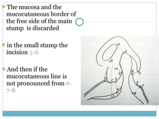 The mucosa and the
mucocutaneous border of
the free side of the main
stump is discarded
in the small stump the
incision 5-6
And then if the
mucocutaneous line is
not pronounced from 6-
7-8
 