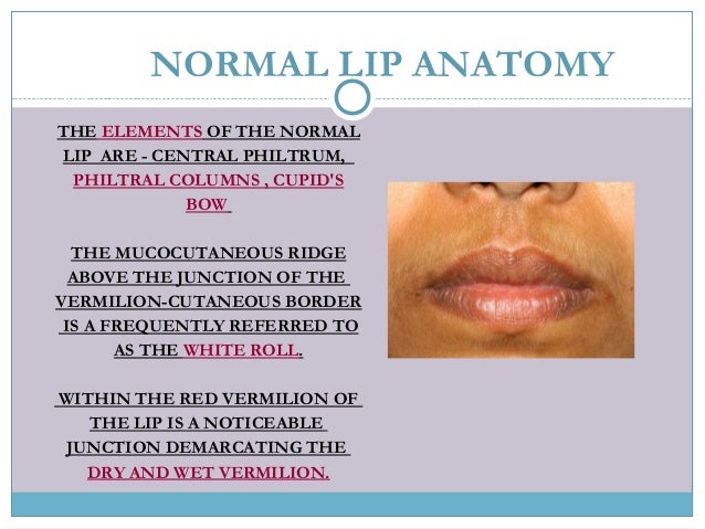 cleft lip