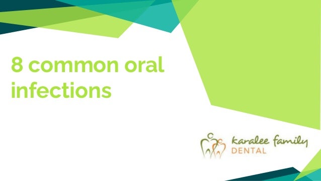 8 common oral
infections
 