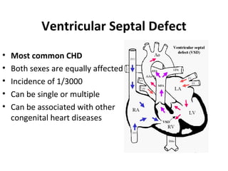 Vsd Incedence congenital heart disease_january2011_final | PPT