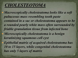  Macroscopically cholesteatoma looks like a soft
pultaceous mass resembling tooth paste
contained in a sac or cholesteatoma appears to be
a rounded pearly white mass often surrounded by
friable granulation tissue from infected bone
 Microscopically cholesteatoma is a benign
keratinizing squamous cell cyst
 Epithelial matrix of acquired cholesteatoma has
10 to 15 layers, while congenital cholesteatoma
has only 5 layers of matrix
11
 
