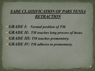  GRADE I: Normal position of TM.
 GRADE II: TM touches long process of incus.
 GRADE III: TM touches promontory.
 GRADE IV: TM adheres to promontory.
36
 