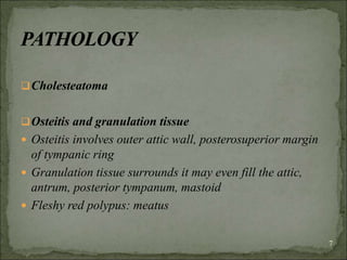 Cholesteatoma
Osteitis and granulation tissue
 Osteitis involves outer attic wall, posterosuperior margin
of tympanic ring
 Granulation tissue surrounds it may even fill the attic,
antrum, posterior tympanum, mastoid
 Fleshy red polypus: meatus
7
 