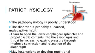 PATHOPHYSIOLOGY
The pathophysiology is poorly understood
The disorder is probably a learned,
maladaptive habit
oLearn to open the lower esophageal sphincter and
propel gastric contents into the esophagus and
throat by increasing gastric pressure through
rhythmic contraction and relaxation of the
diaphragm
May lose weight or develop nutritional
 