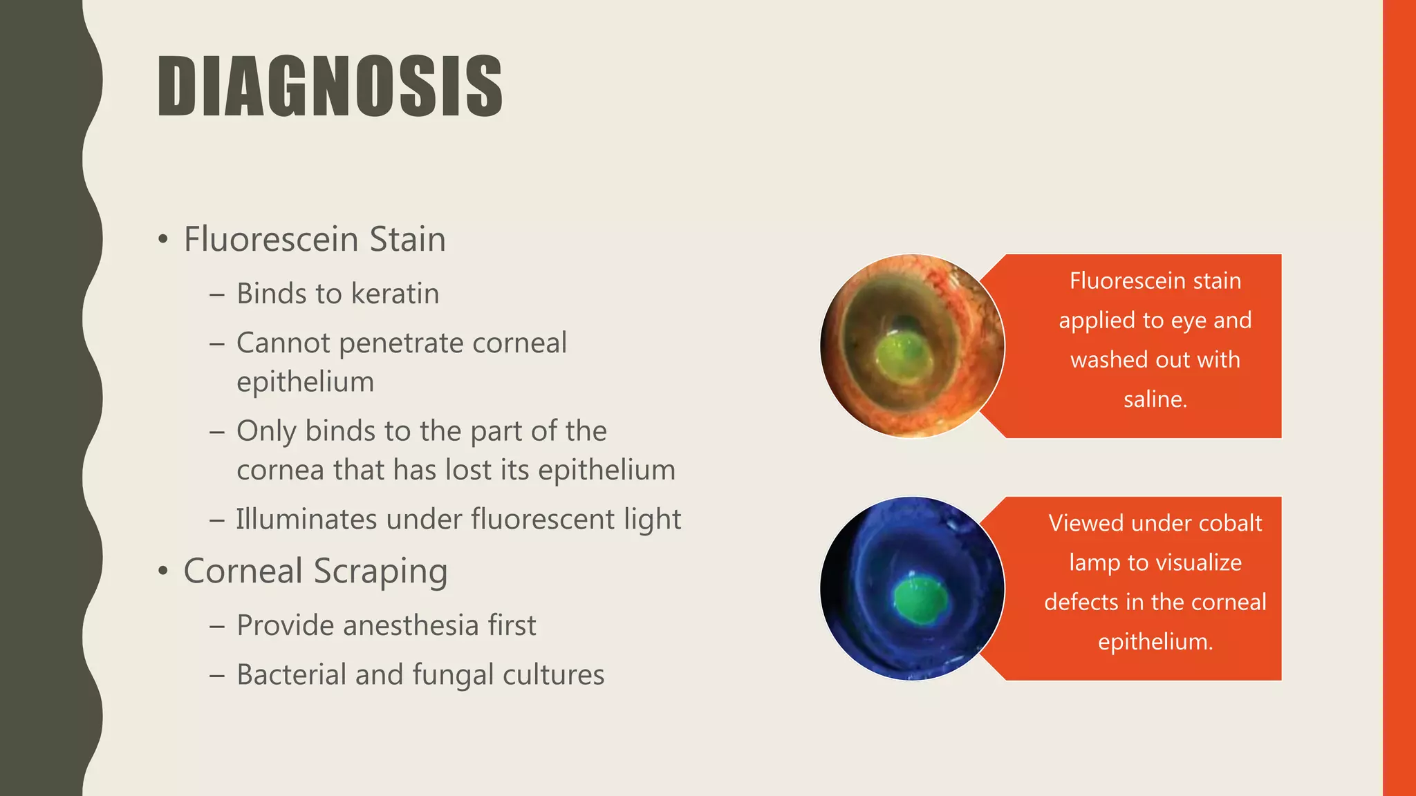 DIAGNOSIS
• Fluorescein Stain
– Binds to keratin
– Cannot penetrate corneal
epithelium
– Only binds to the part of the
cornea that has lost its epithelium
– Illuminates under fluorescent light
• Corneal Scraping
– Provide anesthesia first
– Bacterial and fungal cultures
Fluorescein stain
applied to eye and
washed out with
saline.
Viewed under cobalt
lamp to visualize
defects in the corneal
epithelium.
 