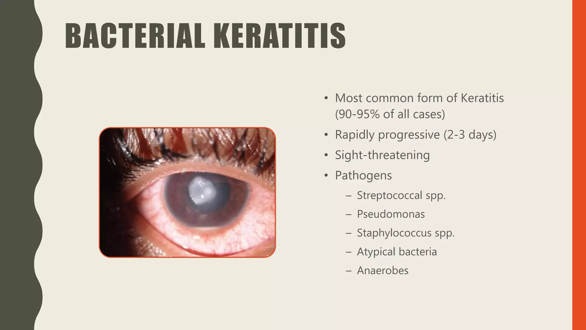 BACTERIAL KERATITIS
• Most common form of Keratitis
(90-95% of all cases)
• Rapidly progressive (2-3 days)
• Sight-threatening
• Pathogens
– Streptococcal spp.
– Pseudomonas
– Staphylococcus spp.
– Atypical bacteria
– Anaerobes
 