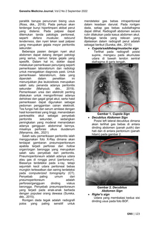 Ganesha Medicina Journal, Vol 2 No 2 September 2022
GMJ | 123
paralitik berupa penurunan bising usus
(Ross, dkk., 2018). Pada perkusi akan
terdengar bunyi hipertimpani akibat perut
yang distensi. Pada palpasi dapat
ditemukan tanda patologis peritoneal,
seperti defans muskular, rebound
tenderness, dan nyeri tekan saat palpasi
yang merupakan gejala mayor peritonitis
sekunder.
Beberapa pasien dengan nyeri akut
abdomen dapat datang dengan patologi
yang serius, namun tanpa gejala yang
spesifik. Dalam hal ini, dokter dapat
melakukan pemeriksaan penunjang seperti
pemeriksaan laboratorium dan radiologi
untuk menegakkan diagnosis pasti. Untuk
pemeriksaan laboratorium, data yang
diperoleh dalam penelitian ini
menunjukkan jika leukositosis merupakan
salah satu penanda adanya peritonitis
sekunder (Mahyoub, dkk., 2019).
Pemeriksaan urea dan elektrolit penting
dilakukan untuk mengonfirmasi adanya
dehidrasi dan gagal ginjal akut, serta hasil
pemeriksaan dapat digunakan sebagai
pedoman penggantian cairan elektrolit.
Tes fungsi hati dan serum amilase dengan
hasil konsentrasi yang tinggi, menandakan
pankreatitis akut sebagai penyebab
peritonitis sekunder, sedangkan
peningkatan yang moderat menandakan
adanya gangguan abdominal lainnya,
misalnya perforasi ulkus duodenum
(Mananna, dkk., 2021)
Salah satu pemeriksaan peritonitis ialah
menggunakan foto X-Ray dimana akan
terdapat gambaran pneumoperitoneum
apabila terjadi perforasi dari hollow
organ/organ berongga yang merupakan
salah satu penyebab dari peritonitis.
Pneumoperitoneum adalah adanya udara
atau gas di rongga perut (peritoneum).
Biasanya terdeteksi pada x-ray, tetapi
sejumlah kecil udara peritoneal bebas
mungkin terlewatkan dan sering terdeteksi
pada computerized tomography (CT).
Penyebab paling umum dari
pneumoperitoneum adalah
perforasi/gangguan dinding viskus
berongga. Penyebab pneumoperitoneum
yang terjadi pada anak-anak berbeda
dengan populasi orang dewasa (Sureka,
dkk., 2015).
Rontgen dada tegak adalah radiografi
polos yang paling sensitif untuk
mendeteksi gas bebas intraperitoneal
dalam keadaan darurat. Pada rontgen
dada, setiap gas bebas subdiafragma
dapat dilihat. Radiografi abdomen secara
rutin dilakukan pada kasus abdomen akut.
Berbagai tanda yang relevan yang
dijelaskan dalam radiografi perut adalah
sebagai berikut (Sureka, dkk., 2015):
• Cupola/saddlebag/mustache sign
Terlihat pada radiografi posisi
supine, mengacu pada akumulasi
udara di bawah tendon sentral
diafragma di garis tengah.
Gambar 1. Cupola Sign
• Decubitus Abdomen Sign
Posisi left lateral decubitus dimana
akan terlihat gas bebas di antara
dinding abdomen (panah putih) dan
hati dan di antara peritonium (panah
hitam) pada gambar 2.
Gambar 2. Decubitus
Abdomen Sign
• Rigler’s sign
Udara yang membatasi kedua sisi
dinding usus pada foto BOF.
 