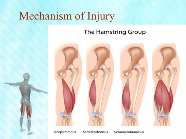 Leg Hamstring Atrophy Interventions for prevention and rehabilitation of hamstring injuries | PPT