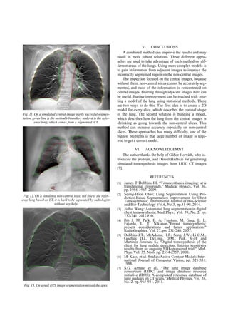 Fig. 11. On a simulated central image partly sucessful segmen-
tation, green line is the method’s boundary and red is the refer-
ence lung, which comes from a segmented CT.
Fig. 12. On a simulated non-central slice, red line is the refer-
ence lung based on CT, it is hard to be separated by radiologists
without any help.
Fig. 13. On a real DTS image segmentation missed the apex.
V. CONCLUSIONS
A combined method can improve the results and may
result in more robust solutions. Three different appro-
aches are used to take advantage of each method on dif-
ferrent areas of the lungs. Using more complex models is
to gain information from adjacent images to improve the
incorrectly segmented region on the non-central images.
The inspection focused on the central images, because
without them, non-central slices cannot be accurately seg-
mented, and most of the information is concentrated on
central images, blurring through adjacent images here can
be useful. Further improvement can be reached with crea-
ting a model of the lung using statistical methods. There
are two ways to do this. The first idea is to create a 2D
model for every slice, which describes the coronal shape
of the lung. The second solution is building a model,
which describes how the lung from the central images is
shrinking as going towards the non-central slices. This
method can increase accuracy especially on non-central
slices. These approaches has many difficulty, one of the
biggest problems is that large number of image is requ-
ired to get a correct model.
VI. ACKNOWLEDGEMNT
The author thanks the help of Gábor Horváth, who in-
troduced the problem, and Dániel Hadházi for generating
simulated tomosynthesis images from LIDC CT images
[7].
REFERENCES
[1] James T Dobbins III, “Tomosynthesis imaging: at a
translational crossroads,” Medical physics, Vol. 36,
pp. 1956-1967, 2009.
[2] Seung-Hoon Chae: Lung Segmentation Using Pre-
diction-Based Segmentation Improvement for Chest
Tomosynthesis; International Journal of Bio-Science
and Bio-Technology Vol.6, No.3, pp.81-90. 2014.
[3] Jiahui Wang: Automated lung segmentation in digital
chest tomosynthesis; Med Phys.; Vol. 39, No. 2: pp.
732-741. 2012 Feb.
[4] [bb J. M. Park, E. A. Franken, M. Garg, L. L.
Fajardo, L. T. Niklason,"Breast tomosynthesis:
present considerations and future applications"
RadioGraphics, Vol. 27, pp. 231-240. 2007.
[5] Dobbins J.T., McAdams, H.P., Song, J.W., Li C.M.,
Godfrey D.J., DeLong, D.M., Paik, S.-H. and
Martinez Jimenes, S., “Digital tomosynthesis of the
chest for lung nodule detection: Interim sensitivity
results from an ongoing NIH-sponsored trial,” Med.
Phys. Vol. 35. No 6, pp. 2554-2557. 2008.
[6] M. Kass, et al. Snakes:Active Contour Models Inter-
national Journal of Computer Vision, pp. 321-331.
1988.
[7] S.G. Armato et al., “The lung image database
consortium (LIDC) and image database resource
initiative (IDRI): A completed reference database of
lung nodules on CT scans,”Medical Physics, Vol. 38,
No. 2. pp. 915-931. 2011.
 