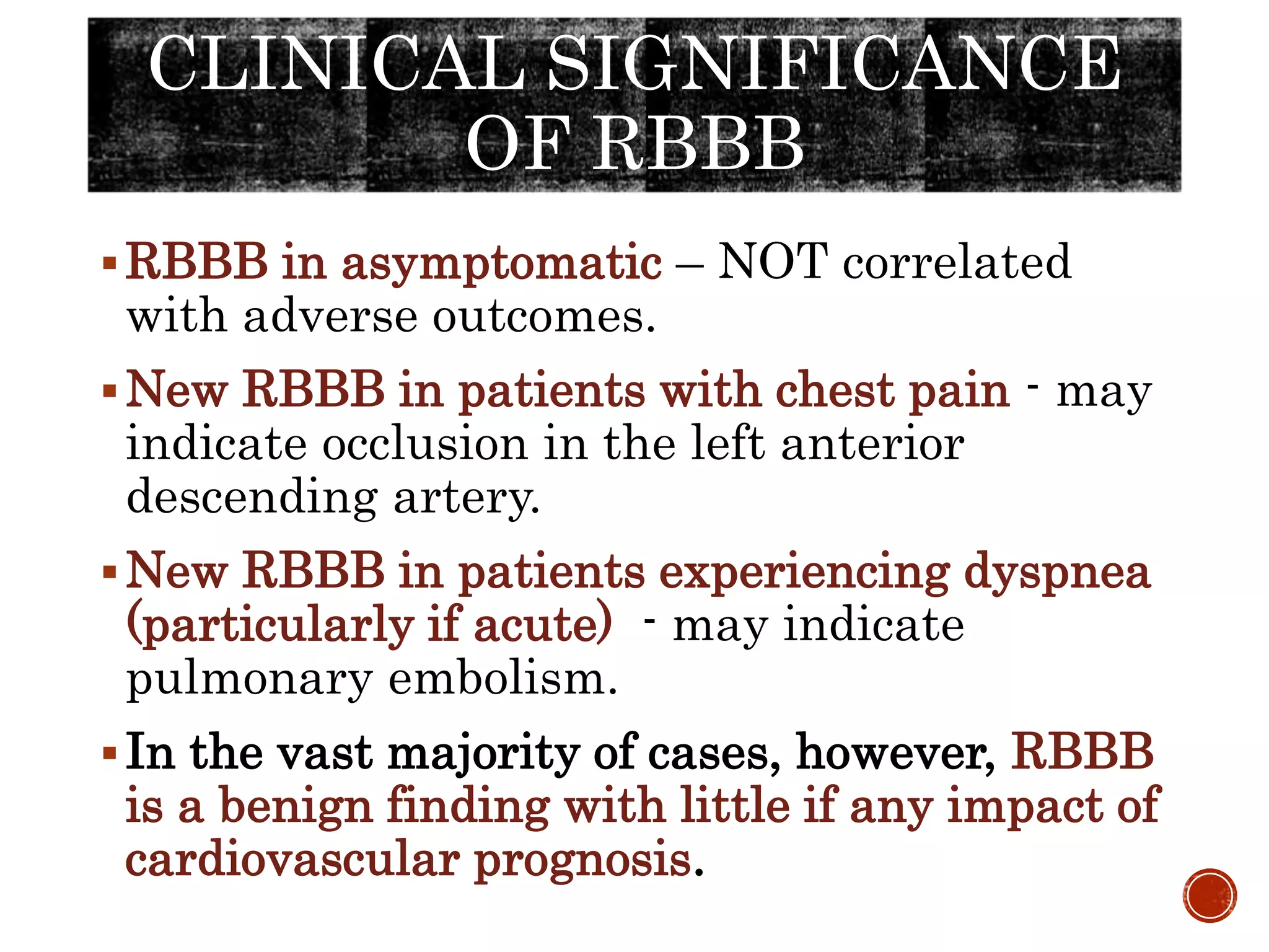 CLINICAL SIGNIFICANCE
OF RBBB
RBBB in asymptomatic – NOT correlated
with adverse outcomes.
New RBBB in patients with chest pain - may
indicate occlusion in the left anterior
descending artery.
New RBBB in patients experiencing dyspnea
(particularly if acute) - may indicate
pulmonary embolism.
In the vast majority of cases, however, RBBB
is a benign finding with little if any impact of
cardiovascular prognosis.
 