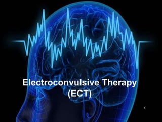 1
Electroconvulsive Therapy
(ECT)
 