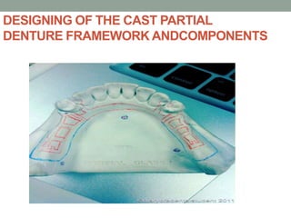 Lower Parital Cast Rpd Examination,diagnosis and treatment planning in rpd | PPTX