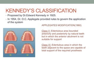 Applegate Classification Examination,diagnosis and treatment planning in rpd | PPTX
