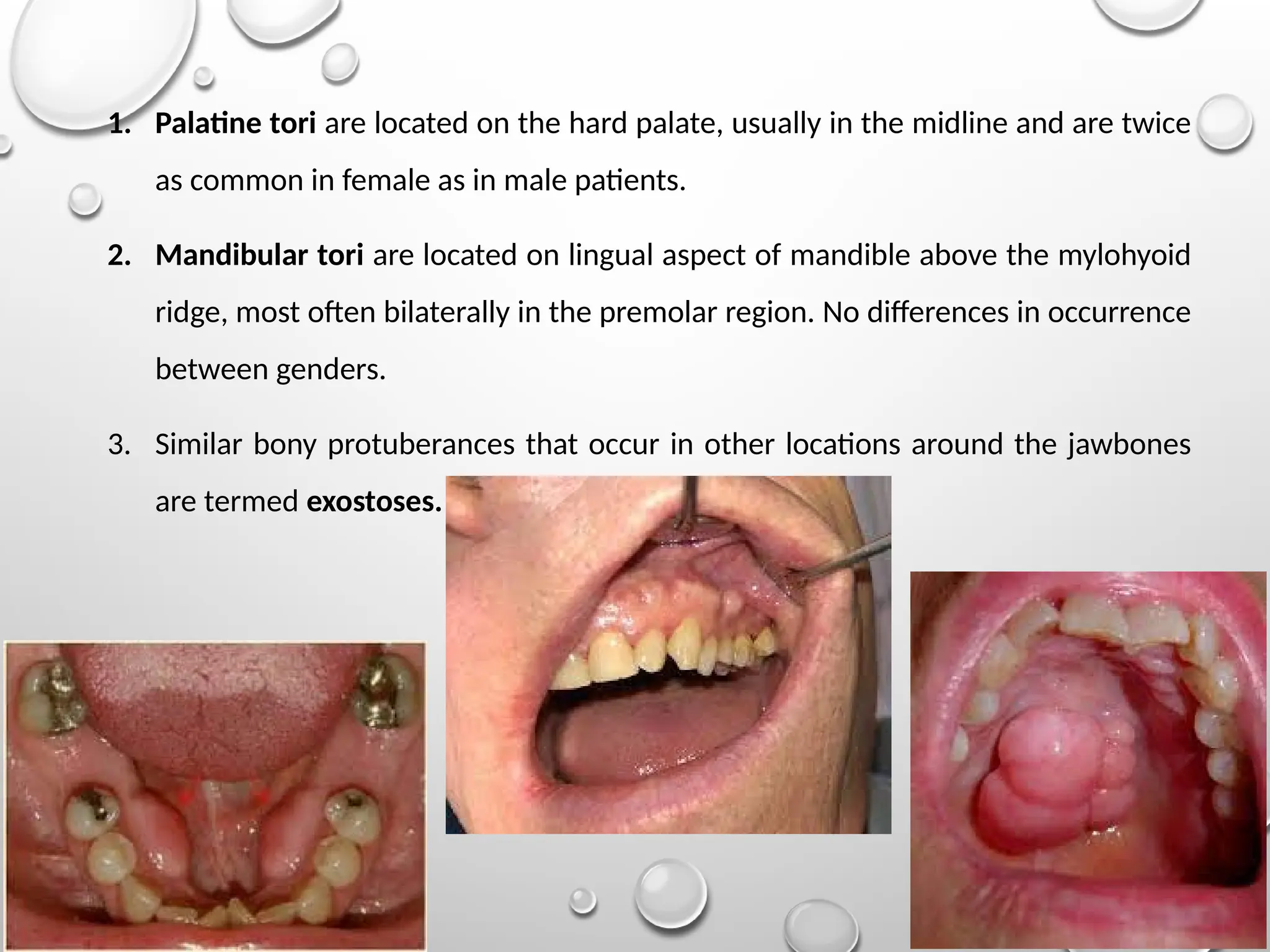 the exophaytic lesions in oral mucosa .pptx