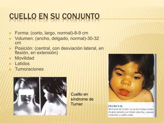 CUELLO EN SU CONJUNTO
 Forma: (corto, largo, normal)-8-9 cm
 Volumen: (ancho, delgado, normal)-30-32
cm
 Posición: (central, con desviación lateral, en
flexión, en extensión)
 Movilidad
 Latidos
 Tumoraciones
Cuello en
síndrome de
Turner
 