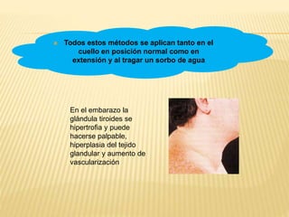  Todos estos métodos se aplican tanto en el
cuello en posición normal como en
extensión y al tragar un sorbo de agua
En el embarazo la
glándula tiroides se
hipertrofia y puede
hacerse palpable,
hiperplasia del tejido
glandular y aumento de
vascularización
 