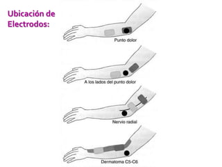Ubicación de
Electrodos:
 