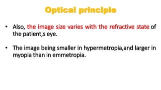 • Also, the image size varies with the refractive state of
the patient,s eye.
• The image being smaller in hypermetropia,and larger in
myopia than in emmetropia.
Optical principle
 