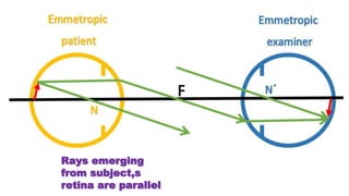 Rays emerging
from subject,s
retina are parallel
 