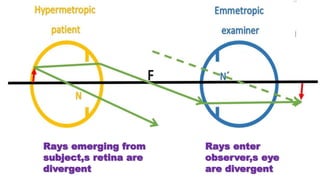 Rays emerging from
subject,s retina are
divergent
Rays enter
observer,s eye
are divergent
 