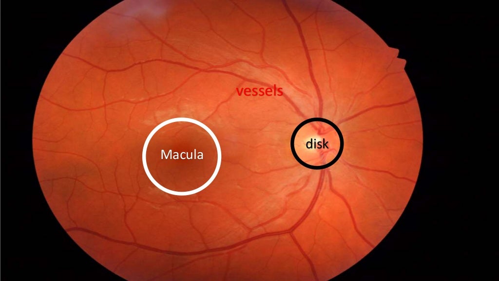 direct ophthalmoscope