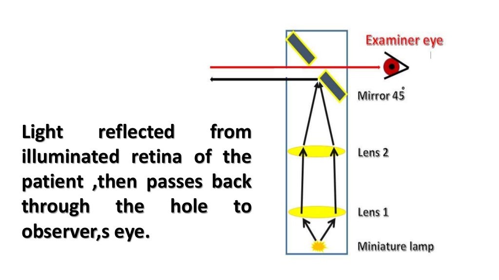 direct ophthalmoscope