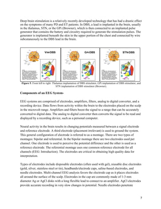 7
Deep brain stimulation is a relatively recently developed technology that has had a drastic effect
on the symptoms of many PD and ET patients. In DBS, a lead is implanted in the brain, usually
in the thalamus, STN, or the GPi (Browner), which is then connected to an implanted pulse
generator that contains the battery and circuitry required to generate the stimulation pulses. The
generator is implanted beneath the skin in the upper portion of the chest and connected by wire
subcutaneously to the DBS lead in the brain.
Figure 5. From left to right: Thalamus implantation of DBS stimulator, GPi implantation of DBS stimulator, and
STN implantation of DBS stimulator (Browner).
Components of an EEG System-
EEG systems are comprised of electrodes, amplifiers, filters, analog to digital converter, and a
recording device. Data flows from activity within the brain to the electrodes placed on the scalp
in the microvolt range. Amplifiers and filters boost the signal to a range that can be accurately
converted to digital data. The analog to digital converter then converts the signal to be read and
displayed by a recording device, such as a personal computer.
Neural activity in the brain results in changing potentials measured between a signal electrode
and reference electrode. A third electrode (placement irrelevant) is used to ground the system.
This general configuration of electrode is referred to as a montage. There are two types of
montages: bipolar and referential. In the bipolar montage there are two electrodes used per
channel. One electrode is used to perceive the potential difference and the other is used as a
reference electrode. The referential montage uses one common reference electrode for all
channels (EEG: Introduction). The electrodes are critical in obtaining high quality data for
interpretation.
Types of electrodes include disposable electrodes (often used with gel), reusable disc electrodes
(gold, silver, stainless steel or tin), headbands/electrode caps, saline-based electrodes, and
needle electrodes. Multi-channel EEG analysis favors the electrode cap as it places electrodes
all around the surface of the scalp. Electrodes in the cap are commonly made of 1-3 mm
diameter Ag or AgCl disks with a long flexible lead to connect to an amplifier. AgCl electrodes
provide accurate recording in very slow changes in potential. Needle electrodes penetrate
 