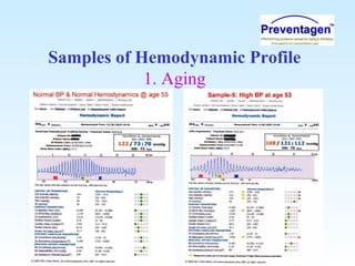 Samples of Hemodynamic Profile
1. Aging
 