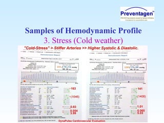 Samples of Hemodynamic Profile
3. Stress (Cold weather)
 