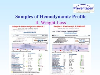 Samples of Hemodynamic Profile
4. Weight Loss
 