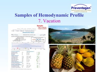 Samples of Hemodynamic Profile
7. Vacation
 