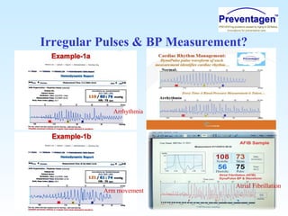 Irregular Pulses & BP Measurement?
Arrhythmia
Arm movement
Atrial Fibrillation
 