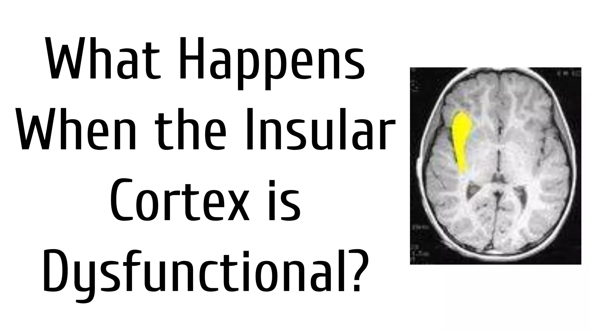 Insular Example The Insular Cortex-Elodi Bodamer GOA Class | PPTX