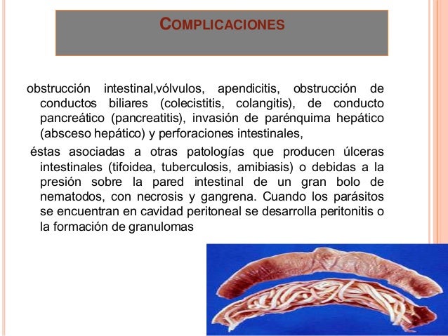 CANDIDA EN EL INTESTINO Y SU INVASIÓN DOCTOR ALEJANDRO SEGEBRE CANDIDA EN EL INTESTINO Y SU INVASIÓN DOCTOR ALEJANDRO SEGEBRE