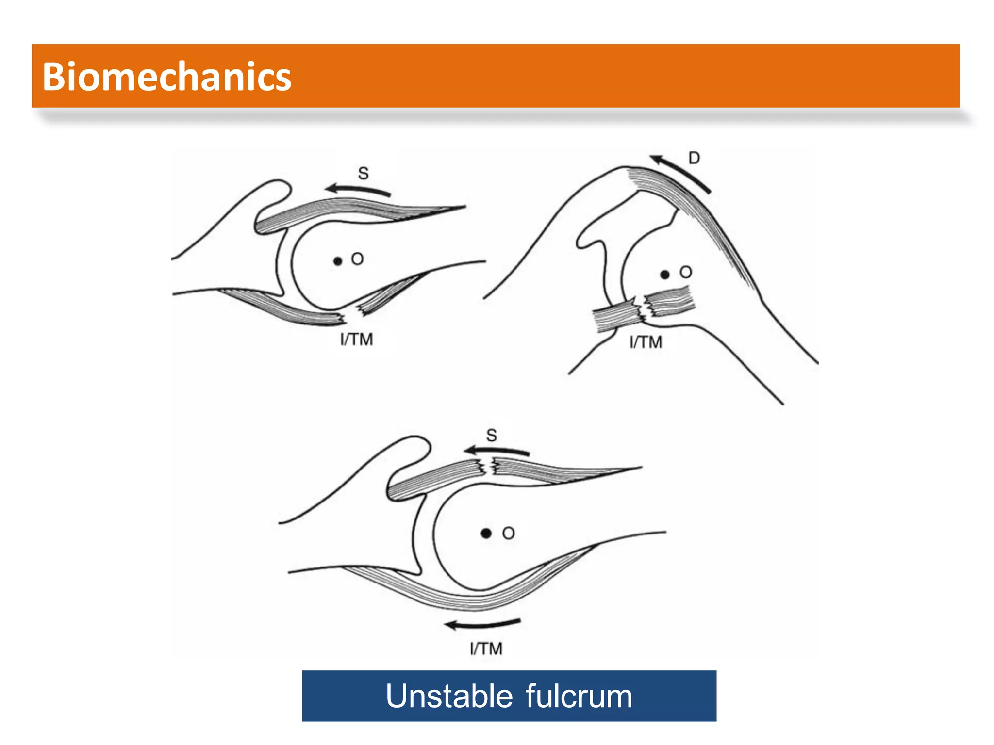 Arthroscopic management of rotator cuff tears larissa 2016 | PDF