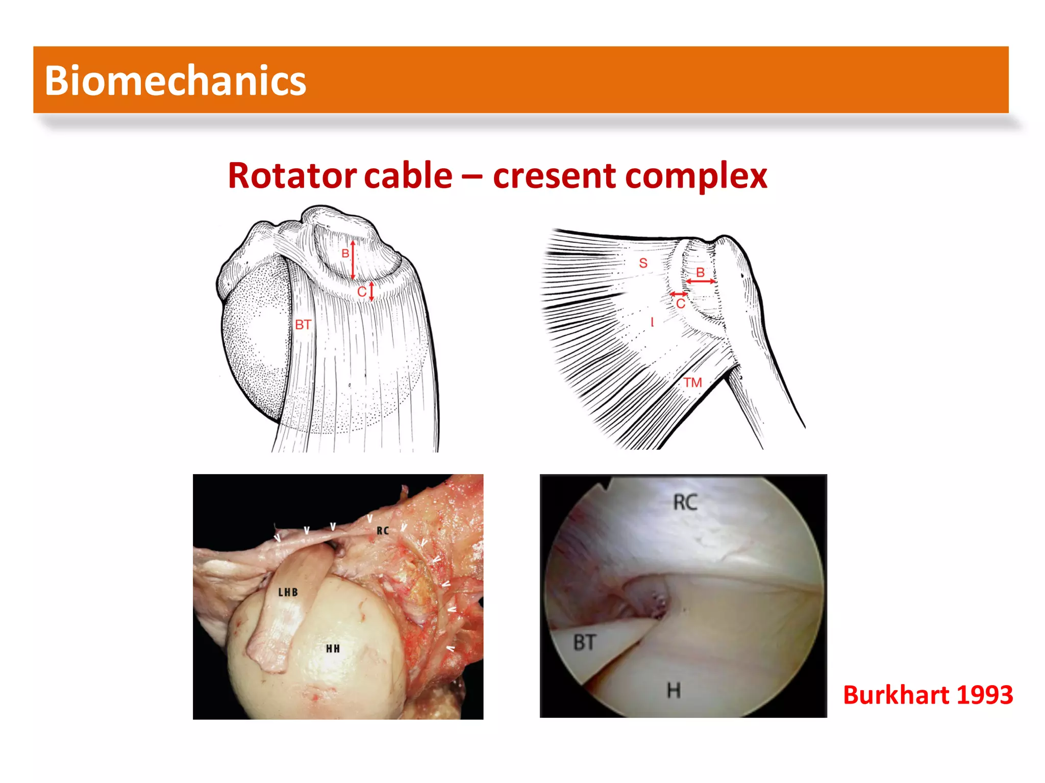 Arthroscopic management of rotator cuff tears larissa 2016 | PDF