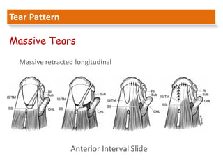 Arthroscopic management of rotator cuff tears larissa 2016 | PDF