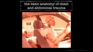 EmergencyMedicineIreland.com
the basic anatomy of chest
and abdominal trauma
 