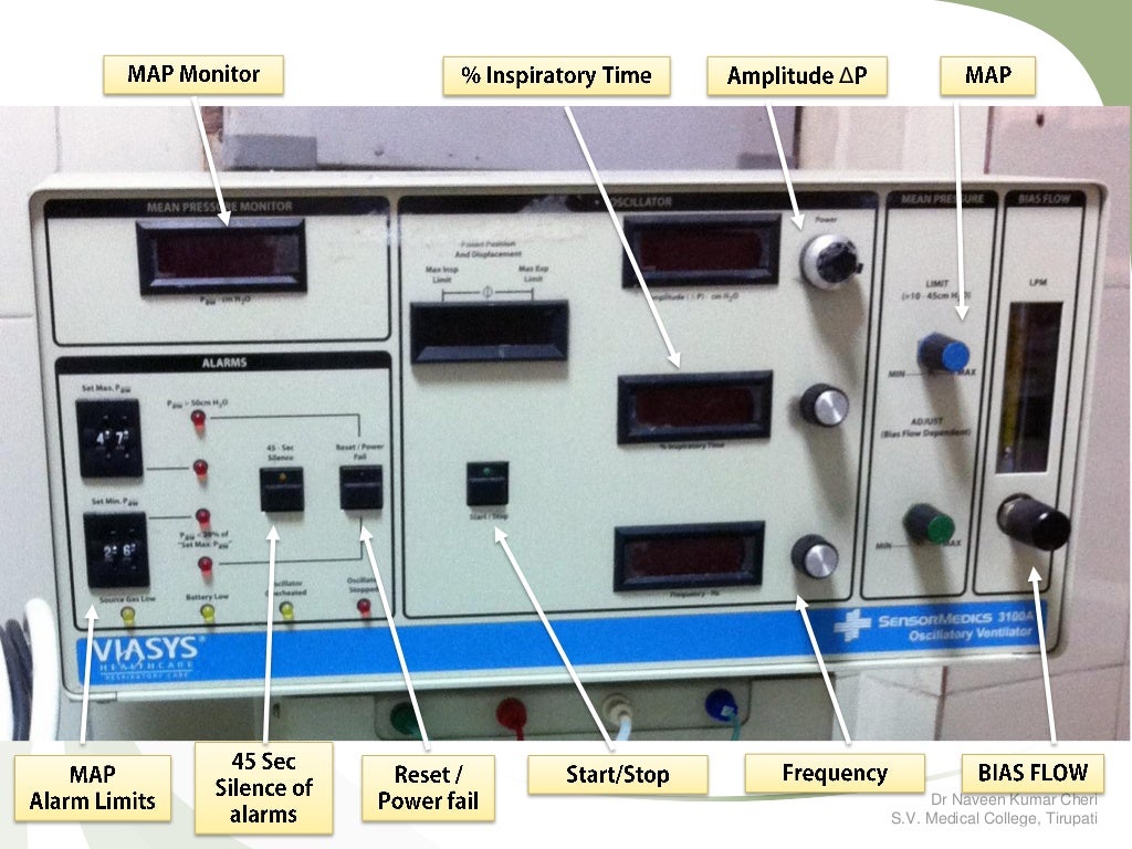 HFOV High Frequency Oscillatory Ventilation