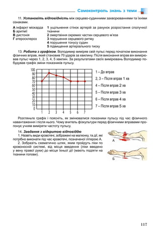 117
11. Установіть відповідність між серцево-судинними захворюваннями та їхніми
ознаками.
А інфаркт міокарда
Б аритмії
В дистонія
Г атеросклероз
1 ущільнення стінок артерій за рахунок розростання сполучної
тканини
2 омертвіння окремих частин серцевого м’яза
3 порушення серцевого ритму
4 порушення тонусу судин
5 підвищення артеріального тиску
13. Робота з графіком. Володимир виміряв свій пульс перед початком виконання
фізичних вправ, який становив 70 ударів за хвилину. Після виконання вправ він вимірю-
вав пульс через 1, 2, 3, 4, 5 хвилин. За результатами своїх вимірювань Володимир по-
будував графік зміни показників пульсу.
Розгляньте графік і поясніть, як змінювалися показники пульсу під час фізичного
навантаження і після нього. Чому вчитель фізкультури перед фізичними вправами про-
понує учням виміряти частоту пульсу.
14. Завдання з відкритою відповіддю
1. Назвіть види кровотечі, зображені на малюнку, та дії, які
потрібно виконати під час кровотечі, позначеної літерою А.
2. Зобразіть схематично шлях, яким пройдуть ліки по
кровоносній системі, від місця введення (ліки введено
у вену правої руки) до місця їхньої дії (мають подіяти на
тканини голови).
А
Б
Самоконтроль знань з теми
 