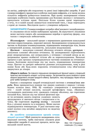 125
§25
íà àíãіíó, äèôòåðіþ àáî ñêàðëàòèíó òà äåÿêі іíøі іíôåêöіéíі õâîðîáè. Ó ðàçі
ãëîìåðóëîíåôðèòó âðàæàєòüñÿ êëóáî÷îê êàïіëÿðіâ íåôðîíіâ, à іç ÷àñîì âåëèêà
êіëüêіñòü íåôðîíіâ ðóéíóєòüñÿ ïîâíіñòþ. Ïðè öüîìó çàõâîðþâàííі ñòіíêè
êàïіëÿðіâ êëóáî÷êіâ ñòàþòü ïðîíèêíèìè äëÿ áіëêîâèõ ìîëåêóë і ïî÷èíàþòü
ïðîïóñêàòè êëіòèíè êðîâі. Îñêіëüêè áіëêè ïëàçìè êðîâі ïåðåõîäÿòü
ó ñå÷ó, òî â ñàìіé ïëàçìі çíèæóєòüñÿ îñìîòè÷íèé òèñê, і âîäà ïåðåõîäèòü
ç êðîâі äî òêàíèí. Íàñëіäêîì öüîãî є óòâîðåííÿ íàáðÿêіâ.
ЗАПАМ’ЯТАЙТЕ! Ãëîìåðóëîíåôðèò ïîòðåáóє îáîâ’ÿçêîâîãî і ÿêíàéøâèäøî-
ãî ëіêóâàííÿ ïіñëÿ ïîÿâè íàéïåðøèõ ïðîÿâіâ. Çà âіäñóòíîñòі ëіêóâàííÿ
ìîæå íàñòàòè ñìåðòü àáî çàõâîðþâàííÿ ïåðåéäå â õðîíі÷íó ôîðìó, ÿêà
òàêîæ є ñìåðòåëüíî íåáåçïå÷íîþ.
Ïієëîíåôðèò – çàïàëüíèé ïðîöåñ ç ïåðåâàæíèì óðàæåííÿì êàíàëüöåâîї
ñèñòåìè íèðêè (çîêðåìà, íèðêîâîї ìèñêè). Çàõâîðþâàííÿ ñóïðîâîäæóєòüñÿ
÷àñòèì òà áîëіñíèì ñå÷îâèïóñêàííÿì, ïіäâèùåííÿì òåìïåðàòóðè òіëà, áîëåì
ó ïîïåðåêîâіé äіëÿíöі, ñîíëèâіñòþ, çàãàëüíèì íåçäóæàííÿì.
Öèñòèò – çàïàëåííÿ ñëèçîâîї îáîëîíêè ñå÷îâîãî ìіõóðà, óðåòðèò –
çàïàëåííÿ ñëèçîâîї îáîëîíêè ñå÷іâíèêà. Öі çàõâîðþâàííÿ ñïðè÷èíþþòü
ðіçíі ìіêðîîðãàíіçìè, ÿêі ïîòðàïëÿþòü ó ñå÷іâíèê і ñå÷îâèé ìіõóð çà íå-
äîòðèìàííÿ ïðàâèë îñîáèñòîї ãіãієíè àáî çà ïåðåîõîëîäæåííÿ. Çàïàëüíі
ïðîöåñè â öèõ îðãàíàõ ñóïðîâîäæóþòüñÿ ÷àñòèìè ïîçèâàìè íà ñå÷îâèïóñ-
êàííÿ, áîëіñíèìè âіä÷óòòÿìè ïіä ÷àñ íüîãî, ïіäâèùåííÿì òåìïåðàòóðè
òîùî. Öèñòèò òà óðåòðèò íåáåçïå÷íі ðіçíèìè óñêëàäíåííÿìè, òîìó â ðàçі
ïîÿâè áîëþ àáî áóäü-ÿêèõ ïîðóøåíü ñå÷îâèïóñêàííÿ ñëіä îáîâ’ÿçêîâî
çâåðíóòèñÿ äî ëіêàðÿ.
Здоров’я людини. За повного порушення сечовидільної функції нирок у лікарській
практиці застосовують апарат «штучна нирка». За допомогою цього апарата з крові
хворого видаляють кінцеві продукти обміну. Зрозуміло, таку процедуру через кілька
днів треба проводити знову.
Îäíієþ ç ïîøèðåíèõ õâîðîá ñå÷îâèäіëüíîї ñèñòåìè є ñå÷îêàì’ÿíà õâî-
ðîáà. Âîíà ïðîÿâëÿєòüñÿ ïîÿâîþ òàê çâàíèõ êàìіíöіâ ó íèðêàõ і ñå÷îâè-
âіäíèõ øëÿõàõ (ìàë. 104). Öі «êàìіíöі» óòâîðþþòüñÿ ç êîìïîíåíòіâ
ñå÷і – ñîëåé ñå÷îâîї êèñëîòè, êàëüöіé îðòîôîñôàòó òîùî. «Êàìіíöі»
óñêëàäíþþòü âèäіëåííÿ ñå÷і, óðàæàþòü ñëèçîâó îáîëîíêó, ùî ñïðè÷èíÿє
ñèëüíèé áіëü. Іíêîëè ïіä ÷àñ âàæêîї ôіçè÷íîї ïðà-
öі ÷è àêòèâíèõ çàíÿòü ñïîðòîì «êàìіíöі» ìîæóòü
çðóøóâàòèñÿ çі çâè÷íîãî ìіñöÿ і ïîòðàïëÿòè â ñå-
÷îâіä. Öå ñïðè÷èíÿє íèðêîâó êîëіêó – ñèëüíèé
áіëü ó äіëÿíöі æèâîòà òà â ïîïåðåêó. Ìîæå çíà÷íî
ïіäâèùóâàòèñÿ òåìïåðàòóðà. Ó ðàçі íàñòàííÿ íèð-
êîâîї êîëіêè ñëіä íåãàéíî çâåðíóòèñÿ ïî ìåäè÷íó
äîïîìîãó.
ßê çàïîáіãòè çàõâîðþâàííÿì îðãàíіâ ñå÷îâè-
äіëüíîї ñèñòåìè? Ùîá óíèêíóòè çàõâîðþâàíü ñå÷î-
âèäіëüíîї ñèñòåìè, òðåáà ñâîє÷àñíî ëіêóâàòè ðіçíі
іíôåêöіéíі õâîðîáè é çàïàëüíі ïðîöåñè, âåñòè ïðà-
âèëüíèé ñïîñіá æèòòÿ.
Мал. 104Мал 104. УтворенняУтворе
«камінців» (1) у нирці
1
 