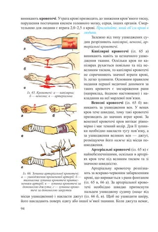 94
виникають кровотечі. Утрата крові призводить до зниження кров’яного тиску,
порушення постачання киснем головного мозку, серця, інших органів. Смер-
тельною для людини є втрата 2,0–2,5 л крові. Пригадайте, який об’єм крові в
людини.
Залежно від типу ушкоджених су-
дин розрізняють капілярні, венозні, ар-
теріальні кровотечі.
Капілярні кровотечі (іл.  65 а)
виникають навіть за незначного ушко-
дження тканин. Оскільки кров по ка-
пілярах рухається повільно та під не-
великим тиском, то капілярні кровотечі
не спричиняють значної втрати крові,
їх легко зупинити. Основним правилом
надання першої медичної допомоги за
таких кровотеч є знезараження рани
(наприклад, йодною настоянкою) і на-
кладання на неї марлевої пов’язки.
Венозні кровотечі (іл.  65 б) ви-
никають за ушкодження вен. У венах
кров тече швидше, тому такі кровотечі
призводять до значних втрат крові. За
венозної кровотечі кров витікає рівно-
мірно і має темний колір. Для її зупин-
ки необхідно накласти тугу пов’язку, а
за ушкодження великих вен  — джгут,
розміщуючи його нижче від місця по-
шкодження.
Артеріальні кровотечі (іл. 65 в) є
найнебезпечнішими, оскільки в артері-
ях кров тече під великим тиском та зі
значною швидкістю.
Артеріальну кровотечу розпізна-
ють за яскраво-червоним забарвленням
крові, що виривається з рани фонтаном
(іл. 65 в, 66 а). За артеріальної крово-
течі необхідно швидко притиснути
пальцем ушкоджену судину (вище від
місця ушкодження) і накласти джгут (іл. 66 б, в). Щоб не ушкодити шкіру,
його накладають поверх одягу або іншої м’якої тканини. Коли джгута немає,
Іл. 65. Кровотечі: а — капілярна;
б — венозна; в — артеріальна
Іл. 66. Зупинка артеріальної кровотечі:
а — ушкодження променевої артерії; б —
тимчасова зупинка кровотечі притис-
ненням артерії; в — зупинка кровотечі за
допомогою джгута; г — зупинка крово-
течі за допомогою закрутки
 