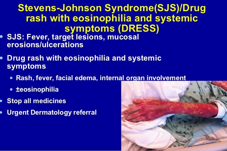 Delayed type drug hypersensitivity