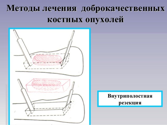 Болит в левой области паха
