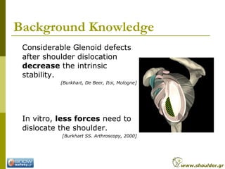 Background Knowledge
Considerable Glenoid defects
after shoulder dislocation
decrease the intrinsic
stability.
[Burkhart, De Beer, Itoi, Mologne]
In vitro, less forces need to
dislocate the shoulder.
[Burkhart SS. Arthroscopy, 2000]
www.shoulder.gr
 