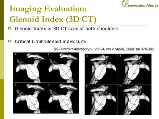 Imaging Evaluation:
Glenoid Index (3D CT)
 Glenoid Index in 3D CT scan of both shoulders
 Critical Limit Glenoid index 0.75
SS Burkhart Arthroscopy: Vol 24, No 4 (April), 2008: pp 376-382
www.shoulder.gr
 
