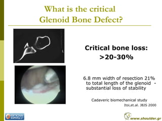 What is the critical
Glenoid Bone Defect?
Critical bone loss:
>20-30%
6.8 mm width of resection 21%
to total length of the glenoid -
substantial loss of stability
Cadaveric biomechanical study
Itoi,et.al. JBJS 2000
www.shoulder.gr
 